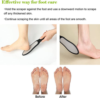 Premium Foot File, Double Side Pedicure Rasp, Dead Hard Cracked Skin Calluses Remover, Portable Foot Care Tool, Heavy Duty Stainless Steel (Soft Silicone Handle)